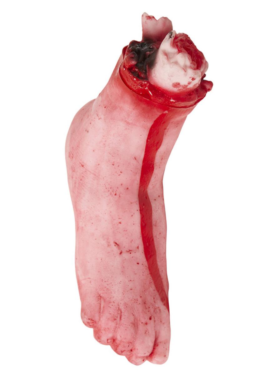 Recom 1