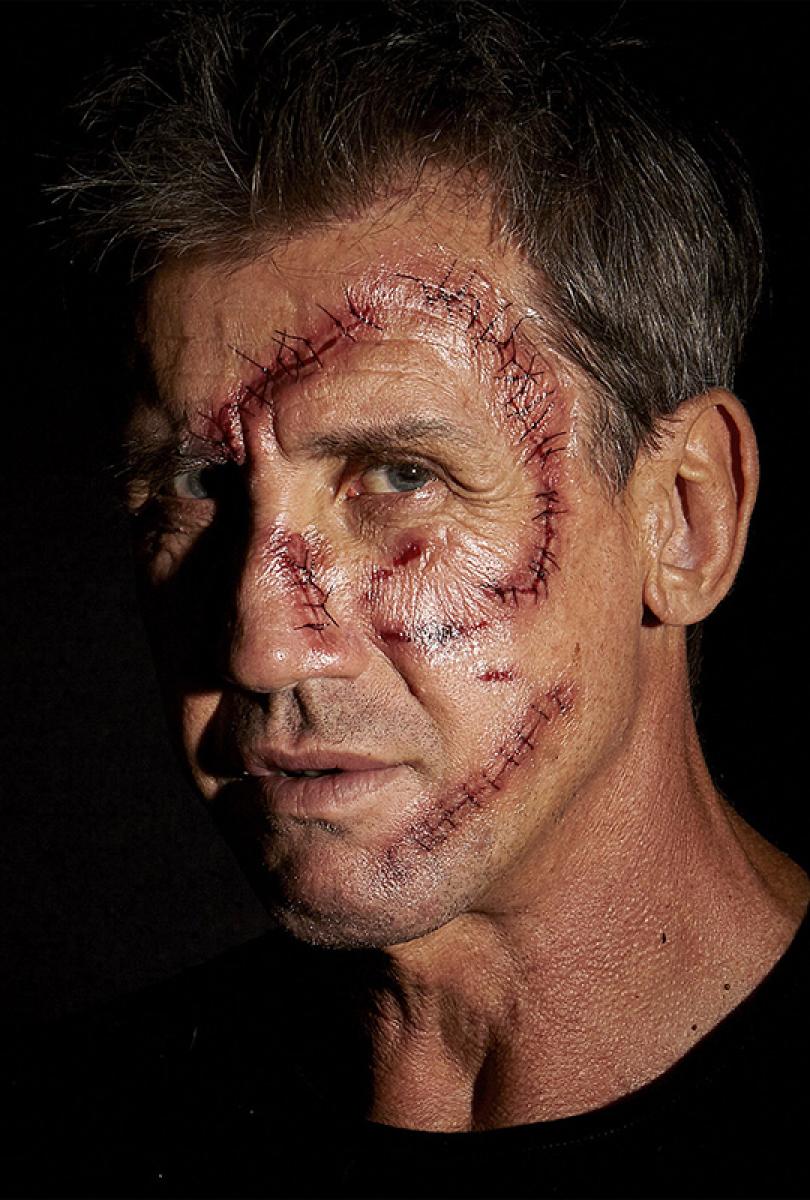 10 Tatouages points de suture