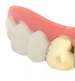 Dentier avec dent en or