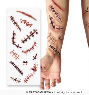 Tatouages blessures cicatrices infectées