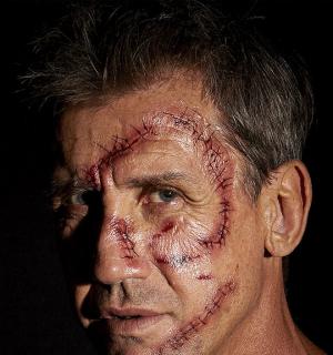 10 Tatouages points de suture